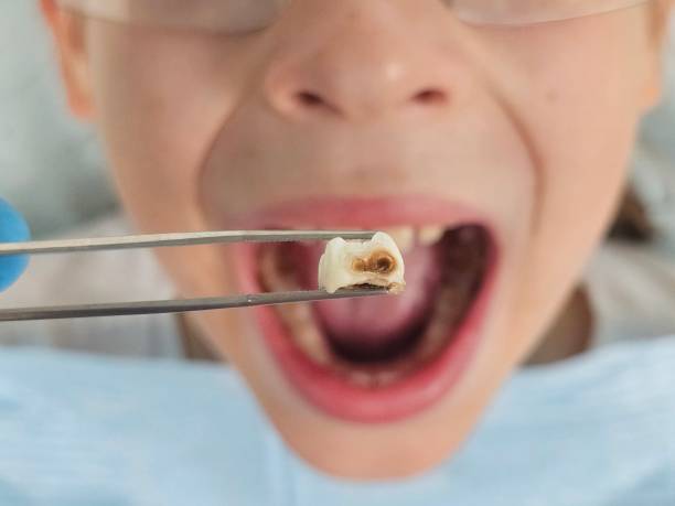 Best Cracked Tooth Emergency Dentist  in Manchester, MI